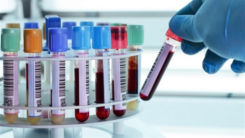 Hastanın Ağrı SeviyesininTespitinde Yeni Yöntem: Kan Testi